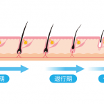 毛周期に合わせたペースが基本！医療レーザー脱毛へ通う間隔