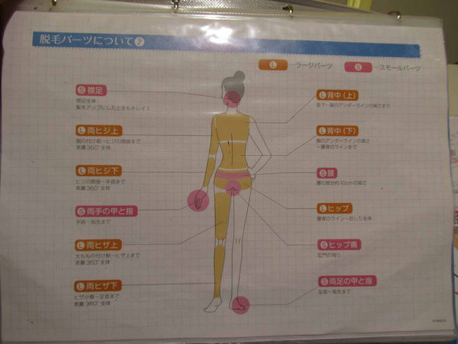 脱毛パーツについて（２）
